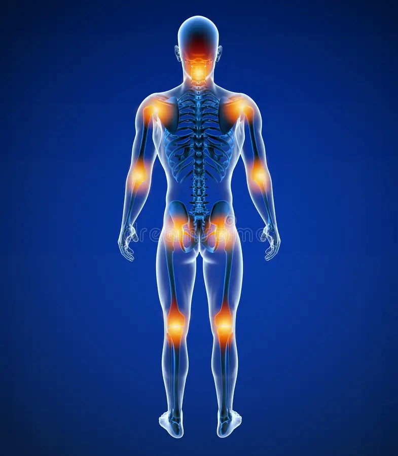 Joint Pain by Body Part